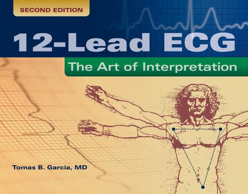 12-Lead ECG: the Art of Interpretation: The Art of Interpretation